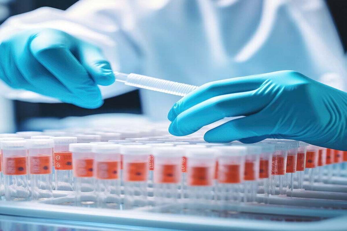 GÓI KIỂM TRA SỨC KHỎE TỔNG QUÁT MỞ RỘNG